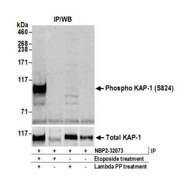 Western Blot: KAP1 [p Ser824] Antibody [NBP2-32073]